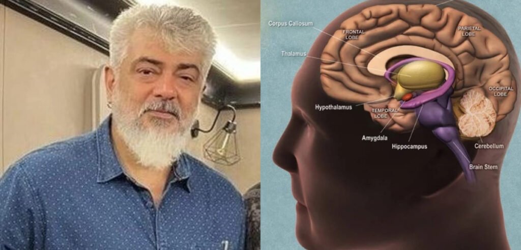 உண்மையில் அஜித்திற்கு மூளையில் ஆபரேசன் நடந்ததா……. ஓபனாக கூறிய பி ஆர் ஒ……