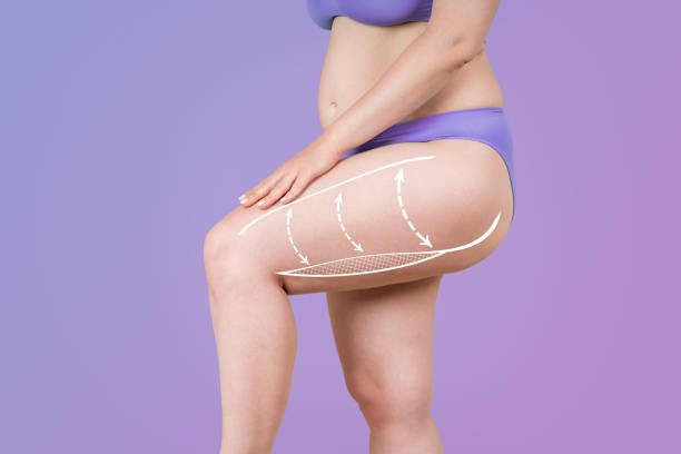Weight Management